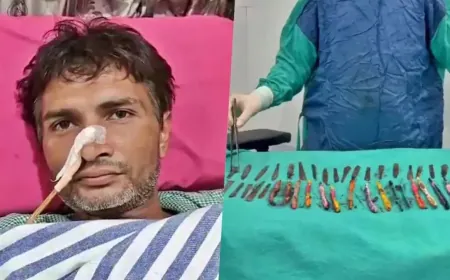 हापुड़ का एक ऐसा शख्स जो गुस्से आकर खा जाता था स्टील की चम्मच और टूथ ब्रश डॉक्टर भी हुए भौचक्के !