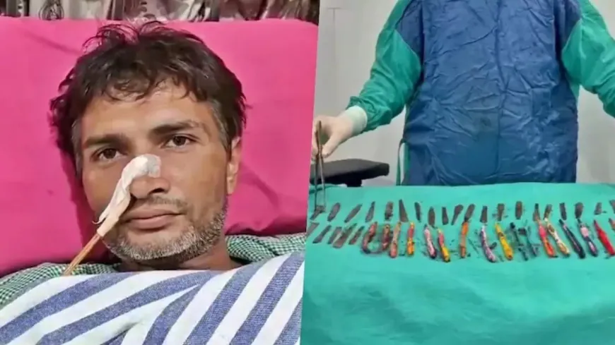 हापुड़ का एक ऐसा शख्स जो गुस्से आकर खा जाता था स्टील की चम्मच और टूथ ब्रश डॉक्टर भी हुए भौचक्के !