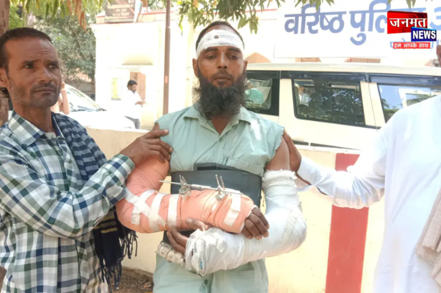 मुजफ्फरनगर: मजदूरी के पैसे मांगे तो छत से फेंका, दोनों हाथ टूटे; SSP से की शिकायत