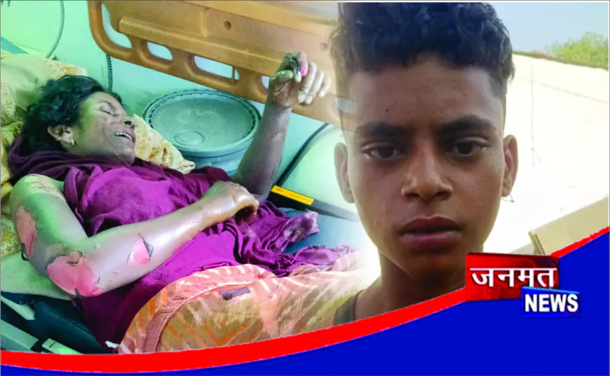 घर में घुसकर महिला को जिंदा जलाने का आरोप, दिल्ली में इलाज के दौरान मौत
