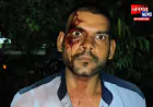 हरदोई में पेट्रोल पंप कर्मचारी से मारपीट, CCTV में कैद हुई दबंगई; अज्ञात आरोपियों पर मुकदमा दर्ज